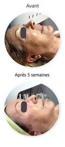 soin visage anti-âge