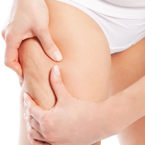 soin anti peau d'orange